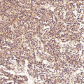 Immunohistochemical analysis of paraffin-embedded Human pituitary tumor, using the Antibody at 1:50 dilution.