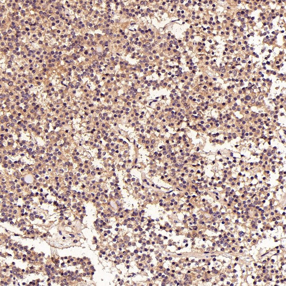 Immunohistochemical analysis of paraffin-embedded Human pituitary tumor, using the Antibody at 1:50 dilution.