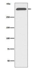 Western blot analysis of ApoB expression in human serum lysate.