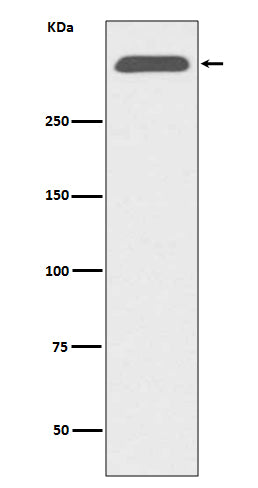 Western blot analysis of ApoB expression in human serum lysate.
