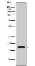 Anti-IL1 beta Rabbit Monoclonal Antibody