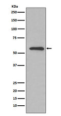 Western blot analysis of Glucose 6 phosphate isomerase expression in HeLa cell lysate.