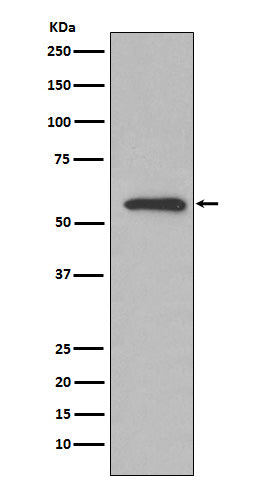 Western blot analysis of Glucose 6 phosphate isomerase expression in HeLa cell lysate.