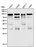 All lanes use the Antibody at 1:1K dilution for 1 hour at room temperature.