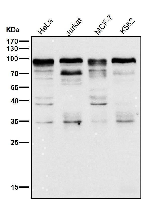 All lanes use the Antibody at 1:1K dilution for 1 hour at room temperature.