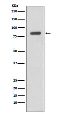 Western blot analysis of IKK beta expression in Daudi cell lysate.