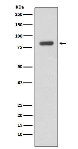 Western blot analysis of IKK beta expression in Daudi cell lysate.