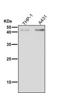 All lanes use the Antibody at 1:2K dilution for 1 hour at room temperature.