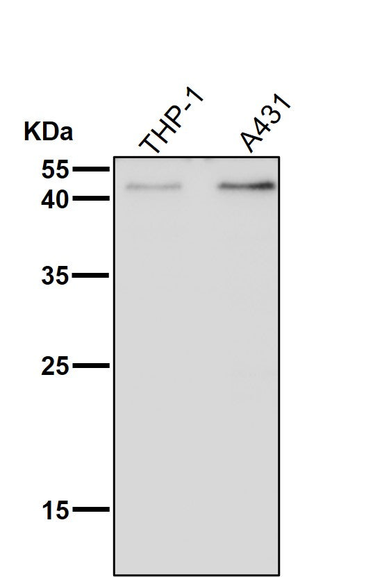 All lanes use the Antibody at 1:2K dilution for 1 hour at room temperature.