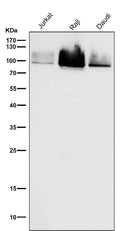 All lanes use the Antibody at 1:1K dilution for 1 hour at room temperature.