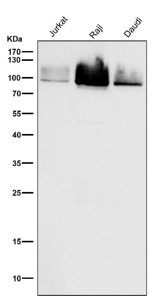 All lanes use the Antibody at 1:1K dilution for 1 hour at room temperature.