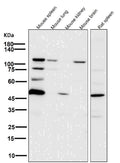 All lanes use the Antibody at 1:6K dilution for 1 hour at room temperature.