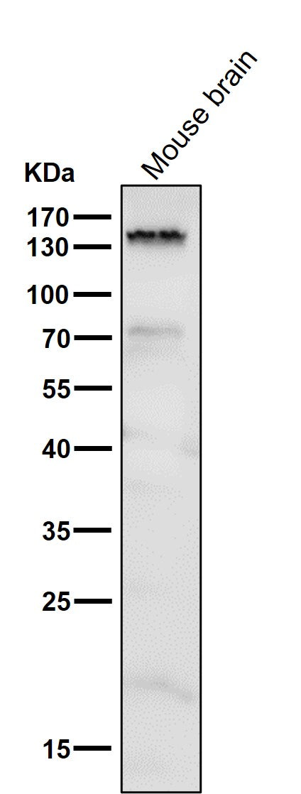 Anti-Brd4 Rabbit Monoclonal Antibody