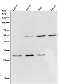 All lanes use the Antibody at 1:2K dilution for 1 hour at room temperature.