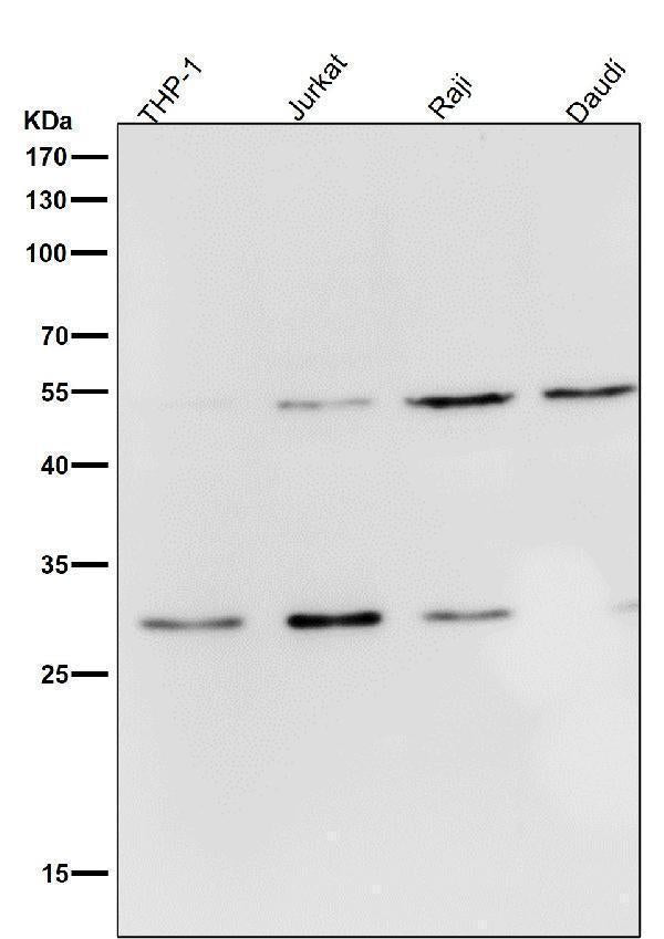 All lanes use the Antibody at 1:2K dilution for 1 hour at room temperature.