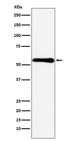 Western blot analysis of CBS expression in MCF7 cell lysate.