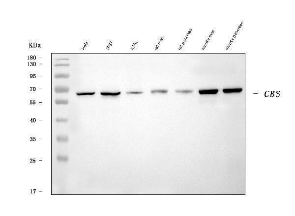 Anti-CBS Antibody Picoband® (monoclonal, 7C3B7)