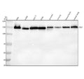 Anti-CTCF Rabbit Monoclonal Antibody