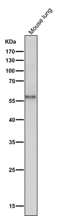 All lanes use the Antibody at 1:2K dilution for 1 hour at room temperature.