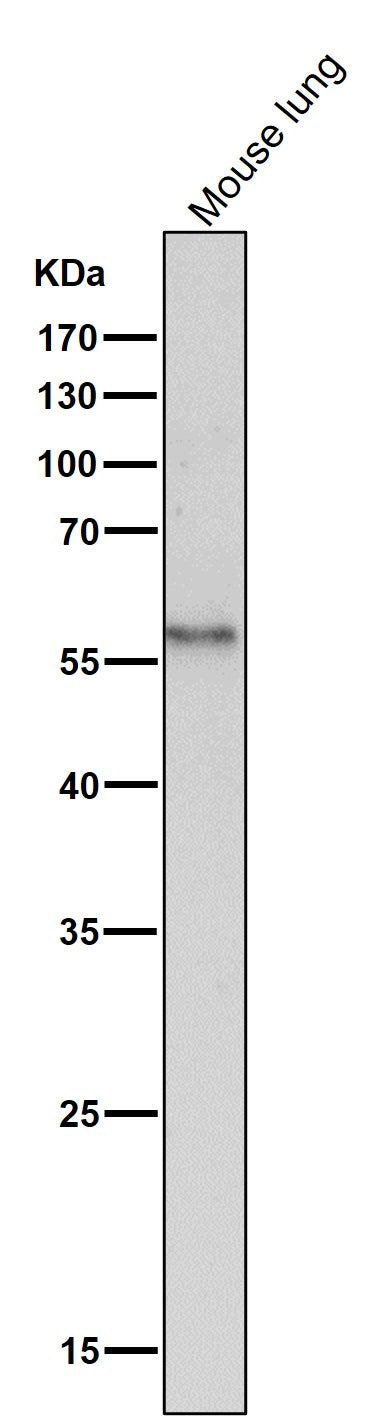 All lanes use the Antibody at 1:2K dilution for 1 hour at room temperature.