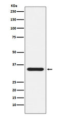 Anti-Presenilin 1 Monoclonal Antibody