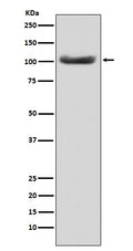 Western blot analysis of MSH2 expression in HeLa cell lysate.