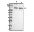 Anti-Bcl-6 Rabbit Monoclonal Antibody