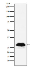 Western blot analysis of Carbonic anhydrase 2 expression in A431 cell lysate.