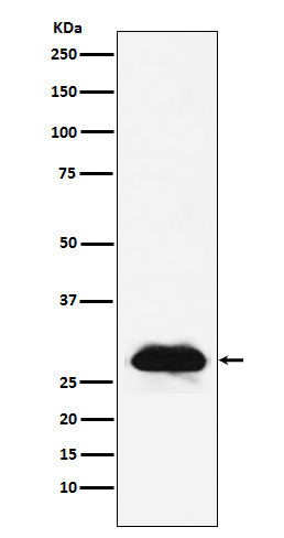 Western blot analysis of Carbonic anhydrase 2 expression in A431 cell lysate.