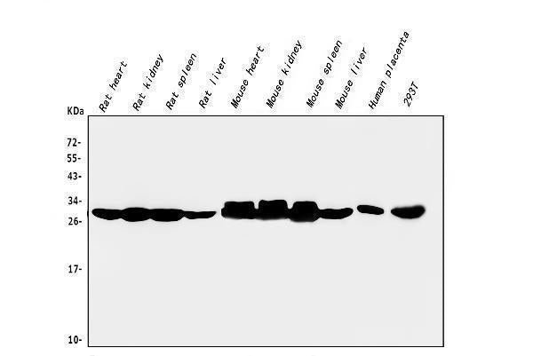 Anti-CA2 Antibody Picoband® (monoclonal, 10E11)