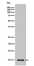 Western blot analysis of Calreticulin expression in IGF1 recombinant protein.