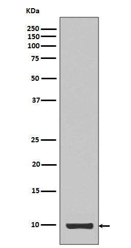 Western blot analysis of Calreticulin expression in IGF1 recombinant protein.
