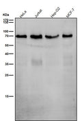 All lanes use the Antibody at 1:1K dilution for 1 hour at room temperature.
