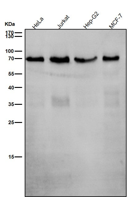 All lanes use the Antibody at 1:1K dilution for 1 hour at room temperature.
