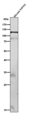 All lanes use the Antibody at 1:2K dilution for 1 hour at room temperature.