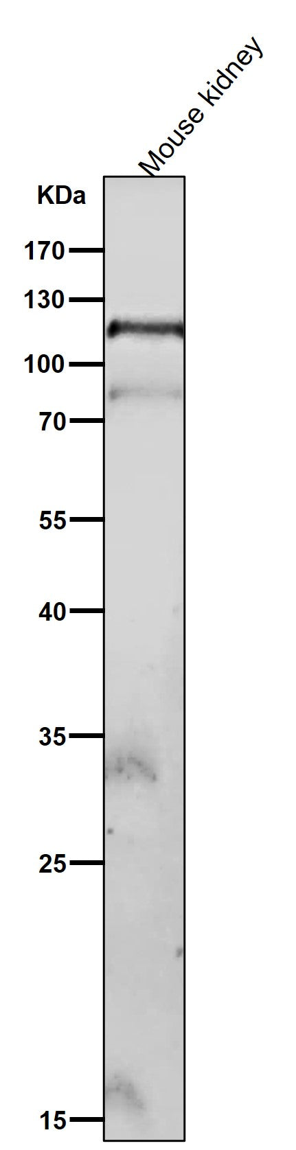 All lanes use the Antibody at 1:2K dilution for 1 hour at room temperature.
