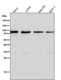 All lanes use the Antibody at 1:2K dilution for 1 hour at room temperature.