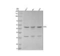 Anti-CCR2/CKR2 Rabbit Monoclonal Antibody