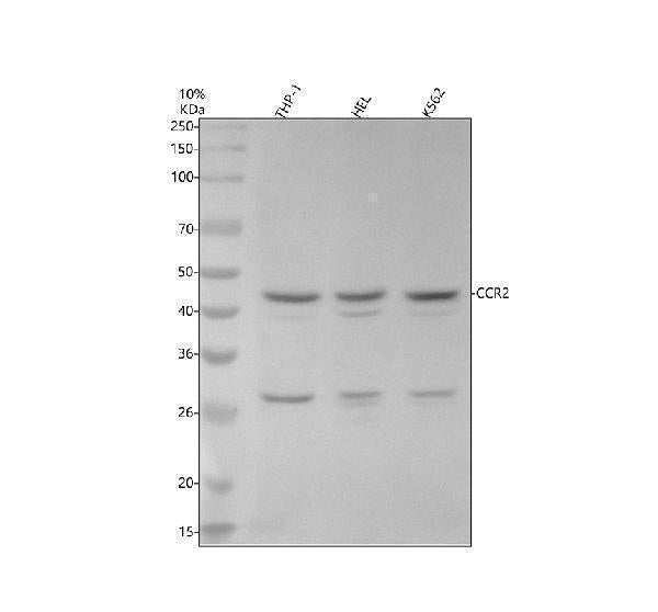 Anti-CCR2/CKR2 Rabbit Monoclonal Antibody