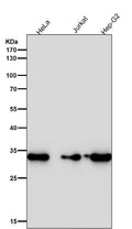 All lanes use the Antibody at 1:2K dilution for 1 hour at room temperature.