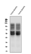 Anti-SLC2A1 Antibody Picoband® (monoclonal, 10C10)