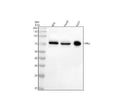 Anti-p63 TP63 Rabbit Monoclonal Antibody