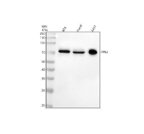 Anti-p63 TP63 Rabbit Monoclonal Antibody