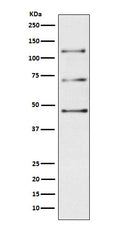 Western blot analysis of C3 / C3a expression in Human plasma lysate.