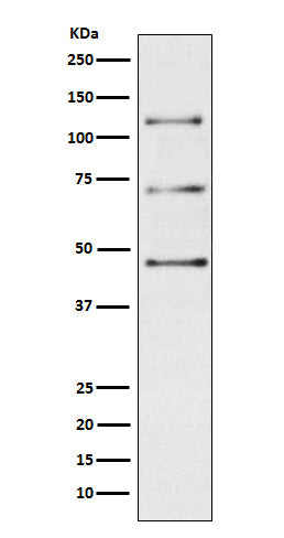 Western blot analysis of C3 / C3a expression in Human plasma lysate.
