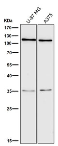 All lanes use the Antibody at 1:2K dilution for 1 hour at room temperature.