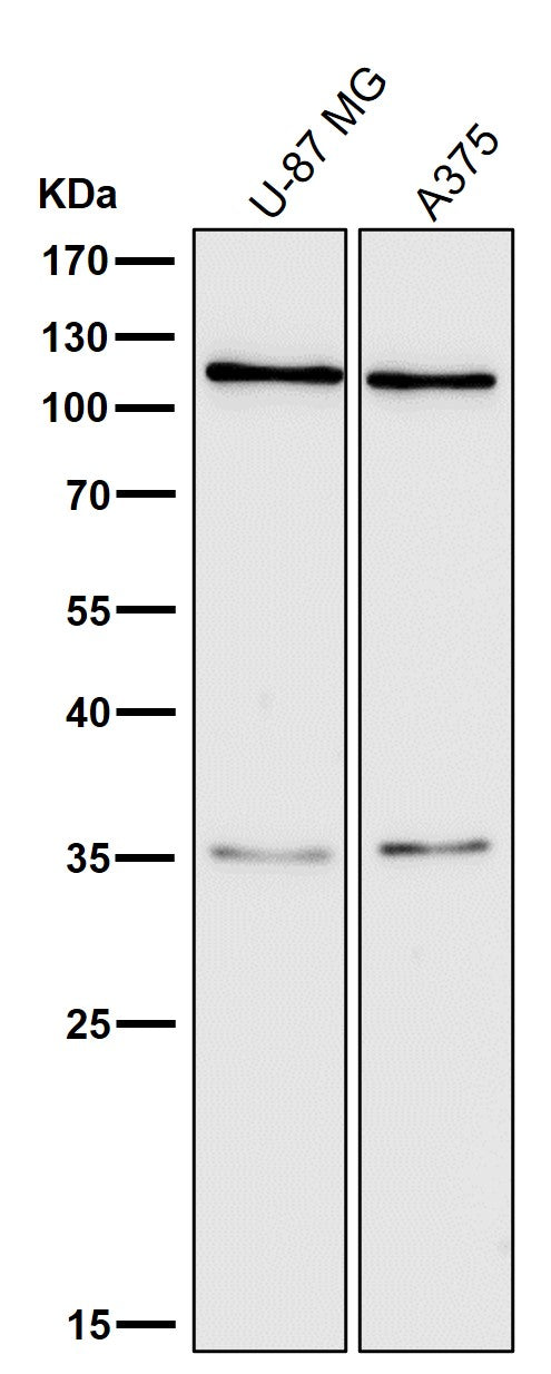 All lanes use the Antibody at 1:2K dilution for 1 hour at room temperature.