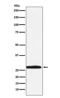Western blot analysis of Carbonic Anhydrase 1 expression in K562 cell lysate.