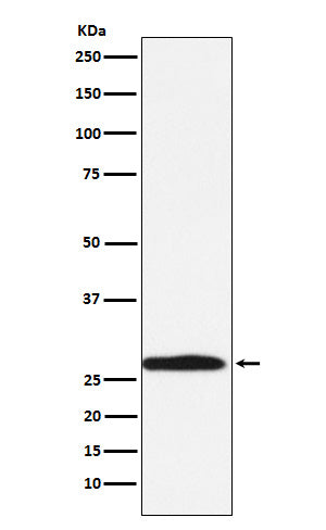 Western blot analysis of Carbonic Anhydrase 1 expression in K562 cell lysate.
