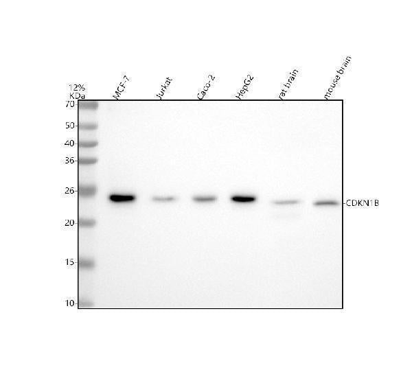 Anti-p27 KIP 1 CDKN1B Rabbit Monoclonal Antibody